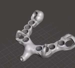 3D printed full arch guide